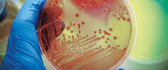 Pathology & Microbiology